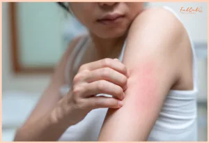 ผิวแพ้ง่าย